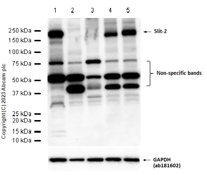 Western blot - Anti-Slit2 antibody [EPR2771] - BSA and Azide free (AB240085)
