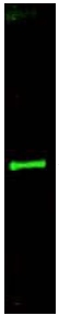 Western blot - Anti-Slit3 antibody (AB11018)
