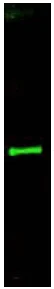 Western blot - Anti-Slit3 antibody (AB11018)