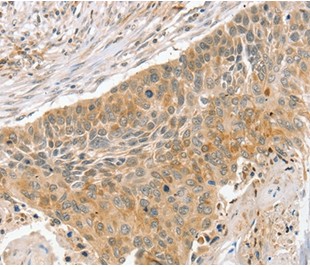 Immunohistochemistry (Formalin/PFA-fixed paraffin-embedded sections) - Anti-Slit3 antibody (AB198726)