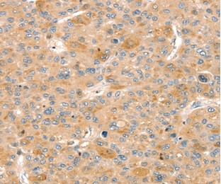 Immunohistochemistry (Formalin/PFA-fixed paraffin-embedded sections) - Anti-Slit3 antibody (AB198726)