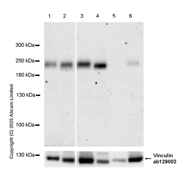 Western blot - Anti-Slit3 antibody [EPR30531-538] (AB325393)