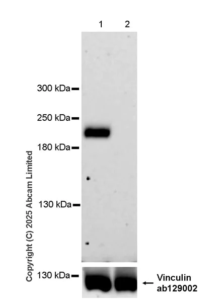 Western blot - Anti-Slit3 antibody [EPR30531-538] (AB325393)