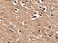Immunohistochemistry (Formalin/PFA-fixed paraffin-embedded sections) - Anti-Slitrk1 antibody (AB67238)