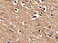 Immunohistochemistry (Formalin/PFA-fixed paraffin-embedded sections) - Anti-Slitrk1 antibody (AB67238)