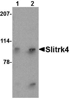 Western blot - Anti-SLITRK4 antibody (AB67308)