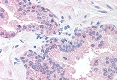 Immunohistochemistry (Formalin/PFA-fixed paraffin-embedded sections) - Anti-SLITRK6 antibody (AB188813)