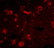 Immunocytochemistry/ Immunofluorescence - Anti-SLITRK6 antibody (AB67312), expandable thumbnail