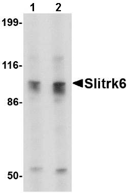 Western blot - Anti-SLITRK6 antibody (AB67312), expandable thumbnail