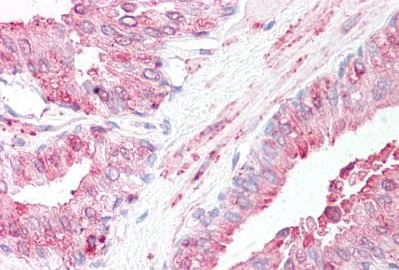 Immunohistochemistry (Formalin/PFA-fixed paraffin-embedded sections) - Anti-SLITRK6 antibody - N-terminal (AB188851)
