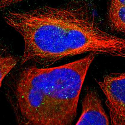Immunocytochemistry/ Immunofluorescence - Anti-SLMAP antibody (AB243383), expandable thumbnail