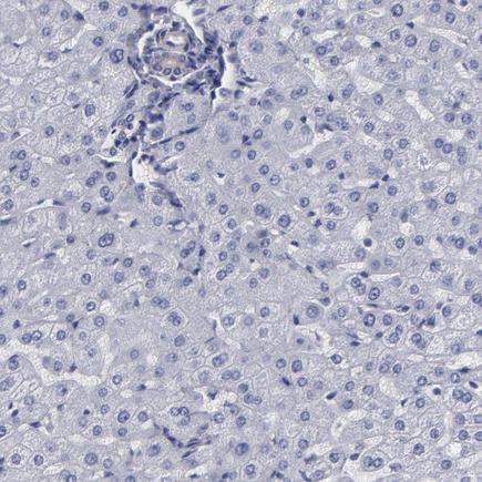 Immunohistochemistry (Formalin/PFA-fixed paraffin-embedded sections) - Anti-SLMAP antibody (ab243383), expandable thumbnail