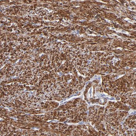 Immunohistochemistry (Formalin/PFA-fixed paraffin-embedded sections) - Anti-SLMAP antibody (AB243383), expandable thumbnail