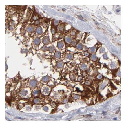 Immunohistochemistry (Formalin/PFA-fixed paraffin-embedded sections) - Anti-SLMAP antibody (AB243383), expandable thumbnail