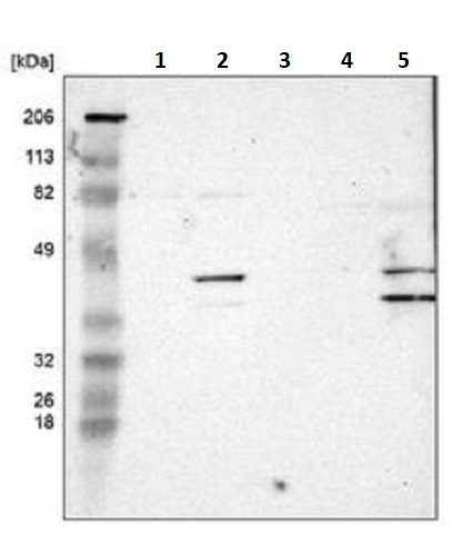 Western blot - Anti-SLMAP antibody (AB243383), expandable thumbnail