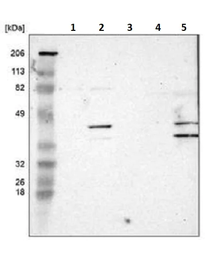 Western blot - Anti-SLMAP antibody (AB243383)