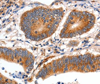 Immunohistochemistry (Formalin/PFA-fixed paraffin-embedded sections) - Anti-Slow Skeletal Myosin Heavy chain antibody - C-terminal (AB197687)