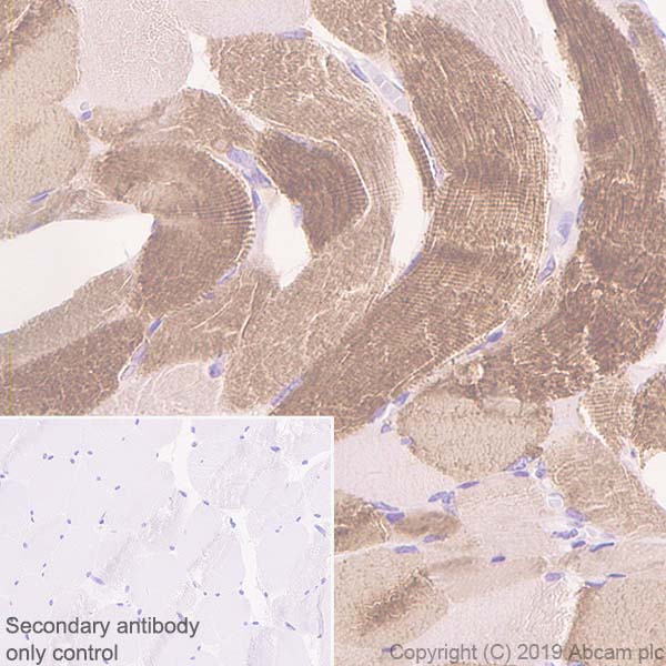 Immunohistochemistry (Formalin/PFA-fixed paraffin-embedded sections) - Anti-Slow Skeletal Myosin Heavy chain antibody [EPR22697-17] (AB234431), expandable thumbnail
