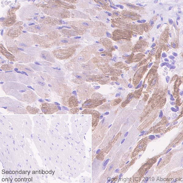 Immunohistochemistry (Formalin/PFA-fixed paraffin-embedded sections) - Anti-Slow Skeletal Myosin Heavy chain antibody [EPR22697-17] (ab234431), expandable thumbnail