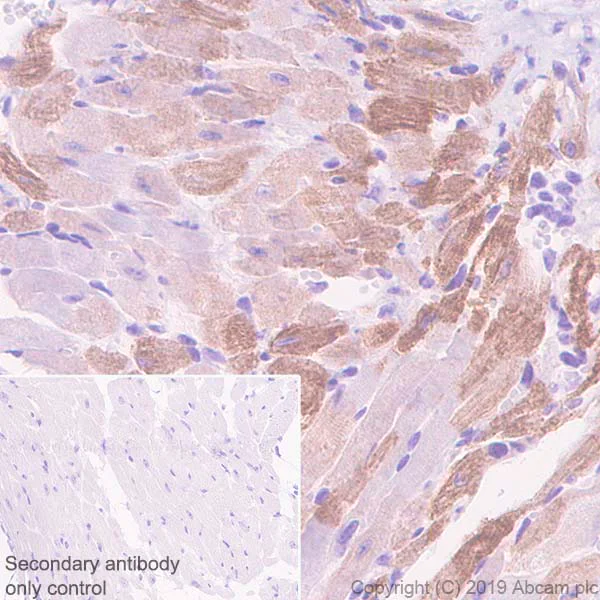 Immunohistochemistry (Formalin/PFA-fixed paraffin-embedded sections) - Anti-Slow Skeletal Myosin Heavy chain antibody [EPR22697-17] (AB234431)