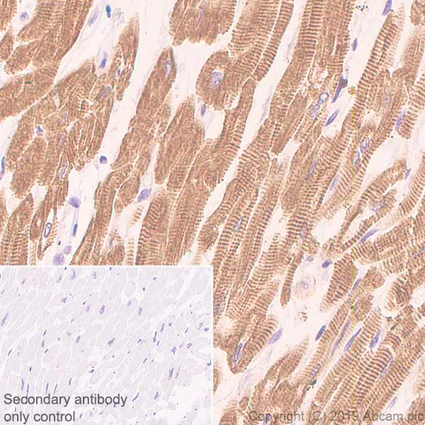 Immunohistochemistry (Formalin/PFA-fixed paraffin-embedded sections) - Anti-Slow Skeletal Myosin Heavy chain antibody [EPR22697-17] (AB234431)