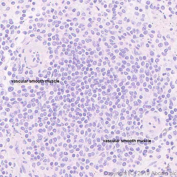 Immunohistochemistry (Formalin/PFA-fixed paraffin-embedded sections) - Anti-Slow Skeletal Myosin Heavy chain antibody [EPR22697-17] (AB234431)