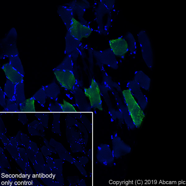 Immunohistochemistry (Frozen sections) - Anti-Slow Skeletal Myosin Heavy chain antibody [EPR22697-17] (AB234431), expandable thumbnail