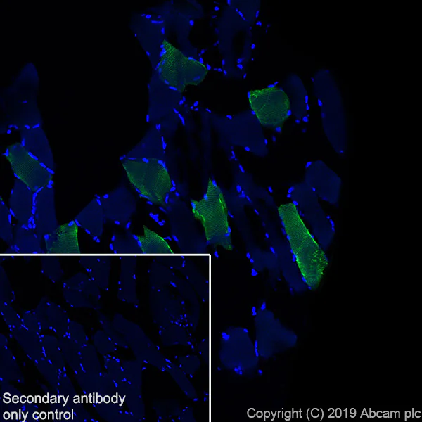 Immunohistochemistry (Frozen sections) - Anti-Slow Skeletal Myosin Heavy chain antibody [EPR22697-17] (AB234431)