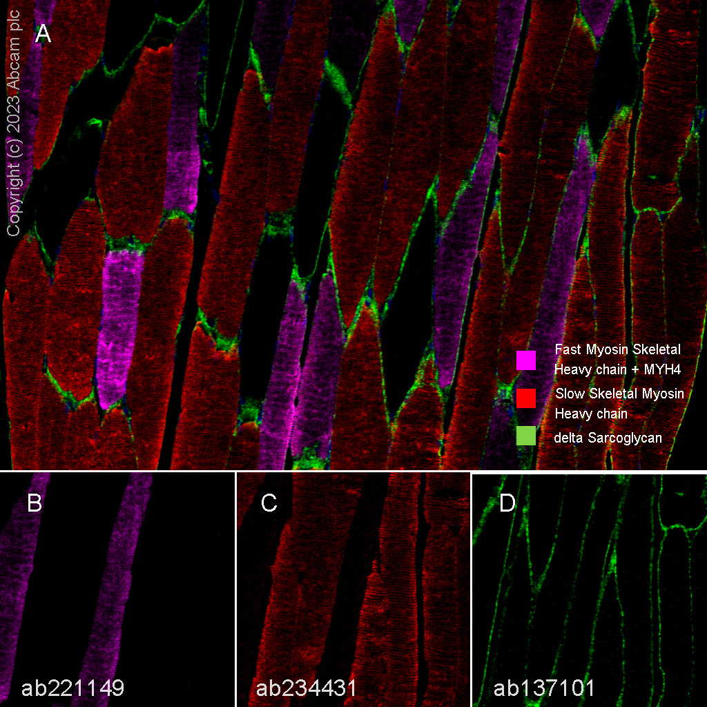 Multiplex immunohistochemistry - Anti-Slow Skeletal Myosin Heavy chain antibody [EPR22697-17] (ab234431), expandable thumbnail