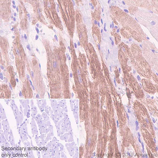 Immunohistochemistry (Formalin/PFA-fixed paraffin-embedded sections) - Anti-Slow Skeletal Myosin Heavy chain antibody [EPR22697-17] - BSA and Azide free (AB255278)