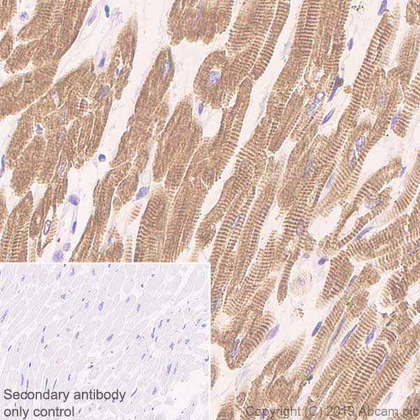 Immunohistochemistry (Formalin/PFA-fixed paraffin-embedded sections) - Anti-Slow Skeletal Myosin Heavy chain antibody [EPR22697-17] - BSA and Azide free (AB255278)