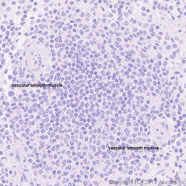 Immunohistochemistry (Formalin/PFA-fixed paraffin-embedded sections) - Anti-Slow Skeletal Myosin Heavy chain antibody [EPR22697-17] - BSA and Azide free (AB255278)