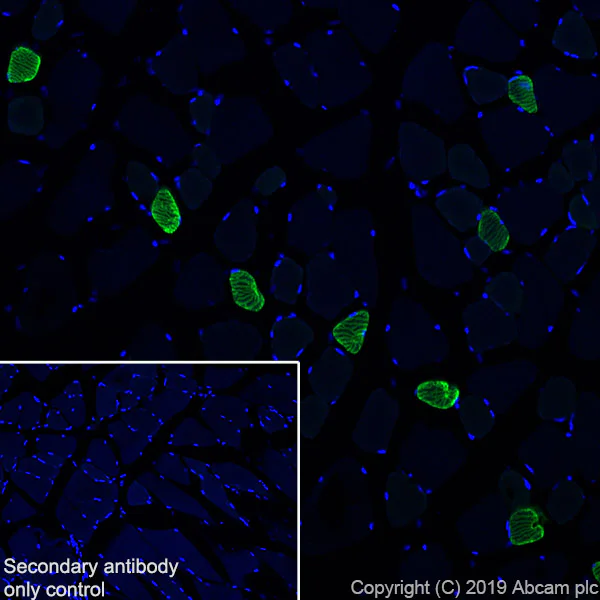 Immunohistochemistry (Frozen sections) - Anti-Slow Skeletal Myosin Heavy chain antibody [EPR22697-17] - BSA and Azide free (AB255278)
