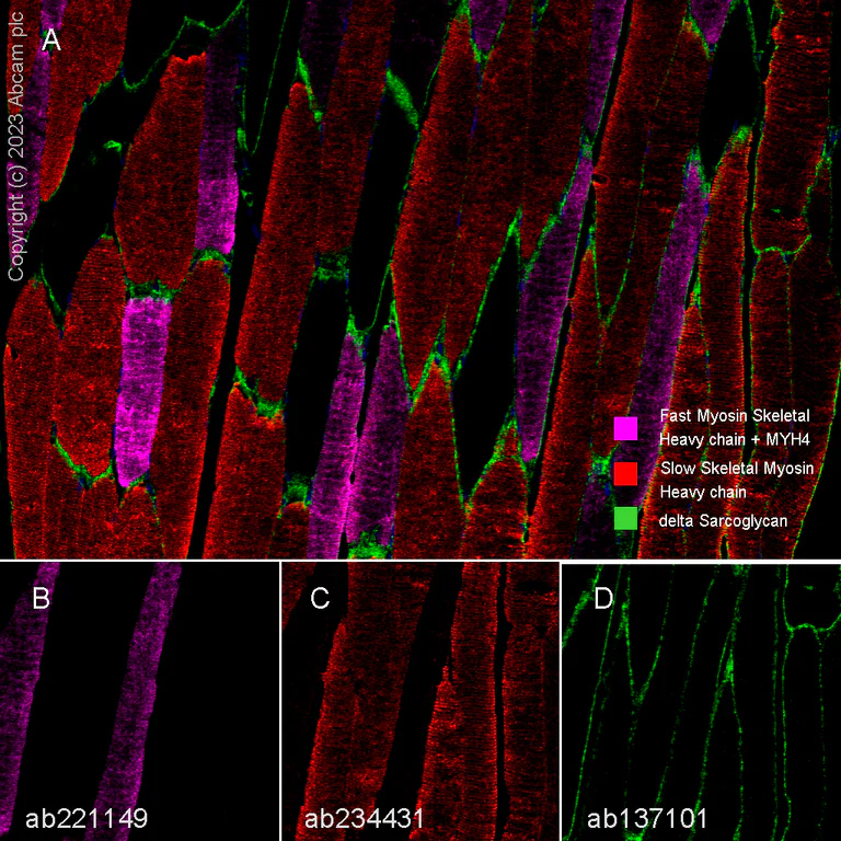 Multiplex immunohistochemistry - Anti-Slow Skeletal Myosin Heavy chain antibody [EPR22697-17] - BSA and Azide free (AB255278)