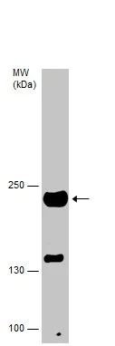 Western blot - Anti-Slow Skeletal Myosin Heavy chain antibody - N-terminal (AB228353)
