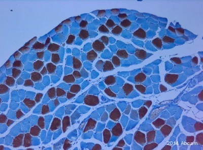 Anti-Slow Skeletal Myosin Heavy chain 抗体 [NOQ7.5.4D] (ab11083