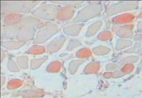 Immunohistochemistry (Formalin/PFA-fixed paraffin-embedded sections) - Anti-Slow Skeletal Myosin Heavy chain antibody [NOQ7.5.4D] (AB11083)
