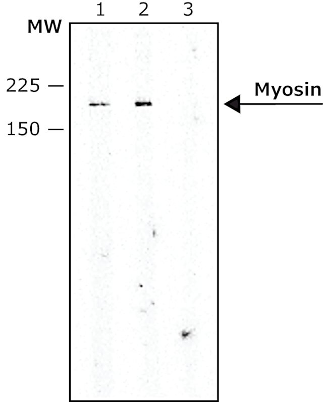 アミンヴイ・aminV Anti-LYVE1 antibody [EPR21857] - Carrier free (ab232935) | Abcam