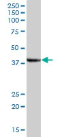 Western blot - Anti-SLP-2 antibody (AB89025)