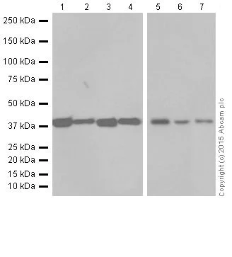 Western blot - Anti-SLP-2 antibody [EP18708] - BSA and Azide free (AB251098)