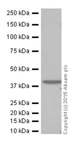 Western blot - Anti-SLP-2 antibody [EPR18718] (AB191883), expandable thumbnail
