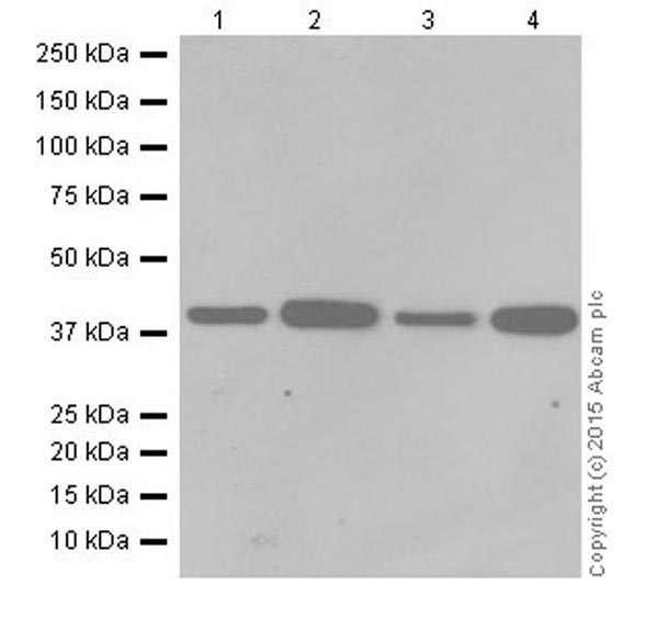 Western blot - Anti-SLP-2 antibody [EPR18718] (AB191883), expandable thumbnail