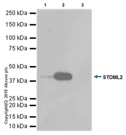 Immunoprecipitation - Anti-SLP-2 antibody [EPR18718] - BSA and Azide free (AB251097)
