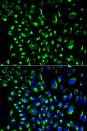 Immunocytochemistry/ Immunofluorescence - Anti-SLP76 antibody (AB196599), expandable thumbnail