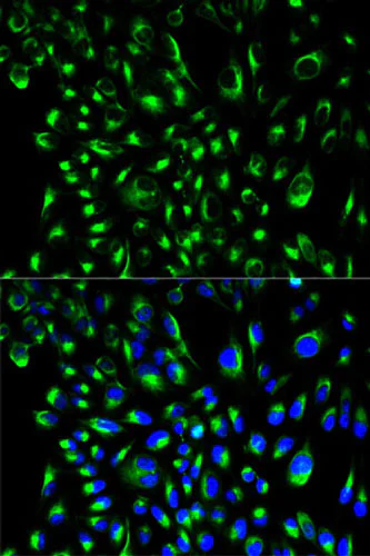 Immunocytochemistry/ Immunofluorescence - Anti-SLP76 antibody (AB196599)