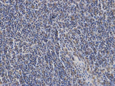 Immunohistochemistry (Formalin/PFA-fixed paraffin-embedded sections) - Anti-SLP76 antibody (AB196599), expandable thumbnail