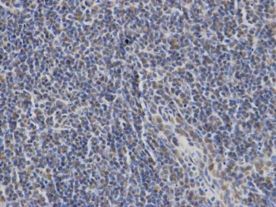 Immunohistochemistry (Formalin/PFA-fixed paraffin-embedded sections) - Anti-SLP76 antibody (AB196599)