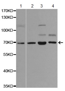 Western blot - Anti-SLP76 antibody (AB196599), expandable thumbnail