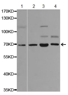 Western blot - Anti-SLP76 antibody (AB196599)