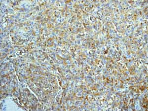 Immunohistochemistry (Formalin/PFA-fixed paraffin-embedded sections) - Anti-SLP76 antibody [EPR2549(2)] (AB109254)